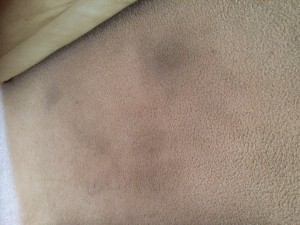 yucky carpet stains